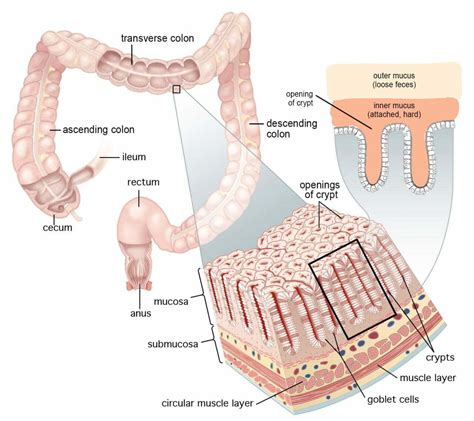 Easiest way to remove Mucoid Plaque by deep colon cleanse