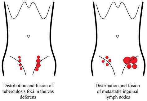 The Role of Contrast-Enhanced Ultrasound in the Differential Diagnosis ...