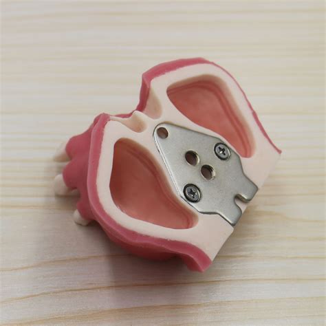 Conduction Anesthesia 的图像结果