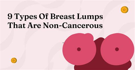 9 Types Of Breast Lumps That Are Non-Cancerous: What Every Nigerian ...