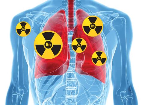 Image result for Radon