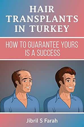 Hair transplants in Turkey: How to guarantee yours is a success eBook ...