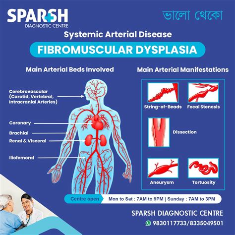 Fibromuscular Dysplasia Symptoms