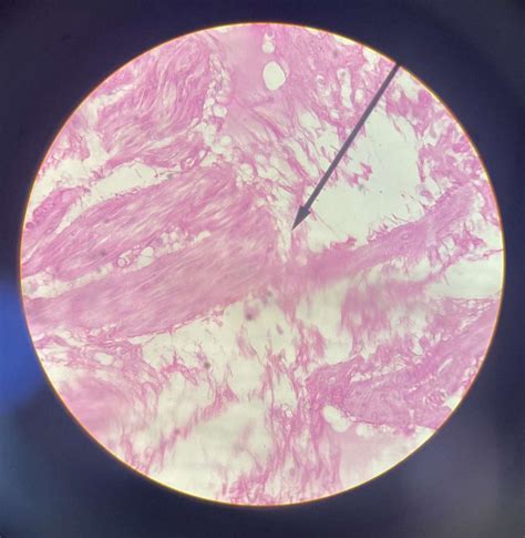 What is Transitional Epithelium?