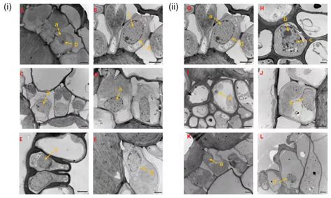Physiological and Molecular Responses of Zoysia japonica to Rust Infection