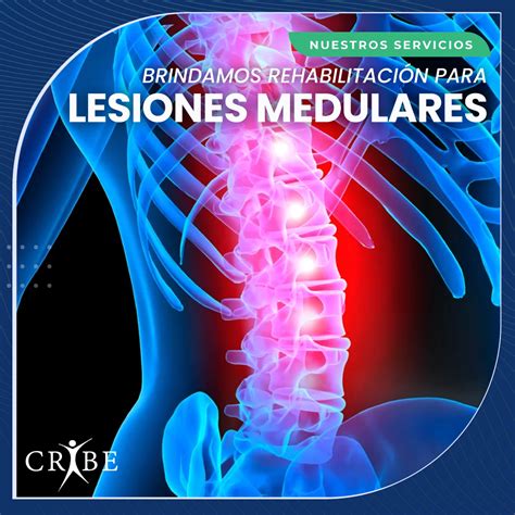 Lesiones Medulares Incapacidad Permanente Por Lesiones Medulares