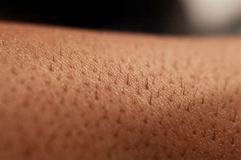 Understanding Folliculitis: Inflamed Hair Follicles | Dermatology Consultants