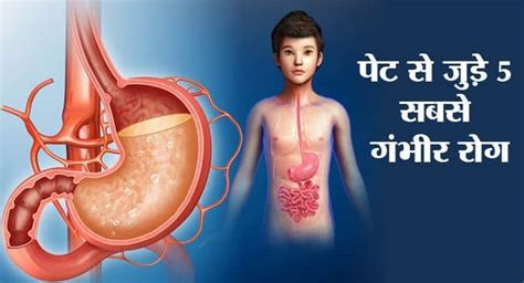 Abdomen Meaning In Hindi: पेट, उदर, कोख - अर्थ, रोग और उपचार