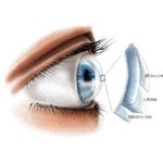 Our Story - Gomabai Netralaya