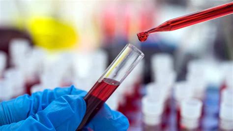 Blue Blood Humans: इंसान का खून भी होता है नीला... इस रंग के पीछे है ये ...