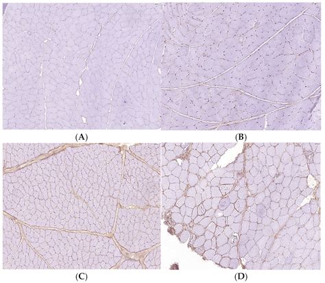 Cathepsin B Levels Correlate with the Severity of Canine Myositis