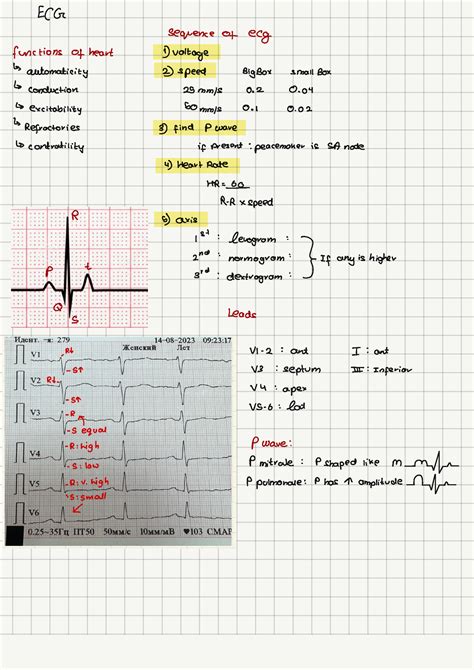 ECG (cheat sheet) - Internal Disease - Studocu