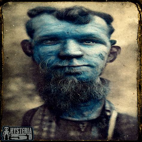 The Fugate Family: The Blue People of Kentucky | 299