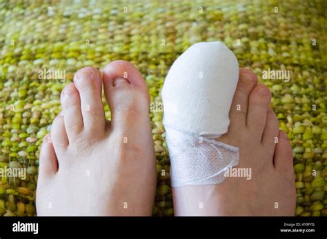 Full Toenail Extraction 的图像结果