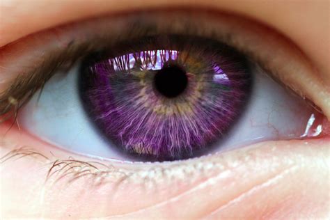 Natural Violet Eyes Purple Eye Disease - Symptoms And Causes