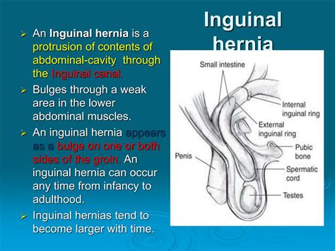 Groin anatomy inguinal hernia clinical anatomy | PPT