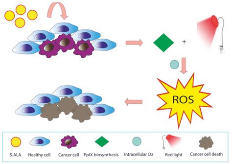 Reactive Oxygen Species Produced by 5-Aminolevulinic Acid Photodynamic ...