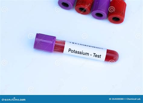 Potassium Test To Look for Abnormalities from Blood Stock Photo - Image ...
