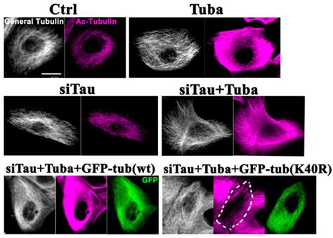 Microtubule Hyperacetylation Enhances KL1-Dependent Micronucleation ...