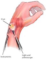 Arthroscopy Surgery/Surgeon – Knee Arthroscopy, Shoulder, Hip, Elbow ...