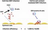 Epstein-Barr Virus (EBV)-associated Gastric Carcinoma