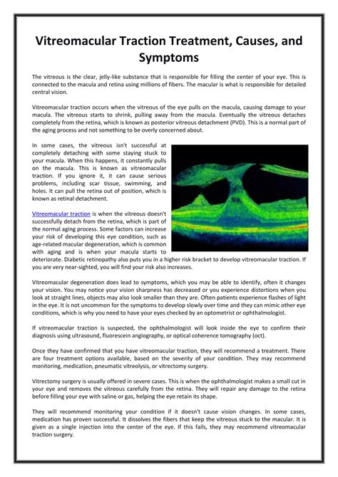 Vitreomacular Traction Treatment, Causes, and Symptoms.pdf