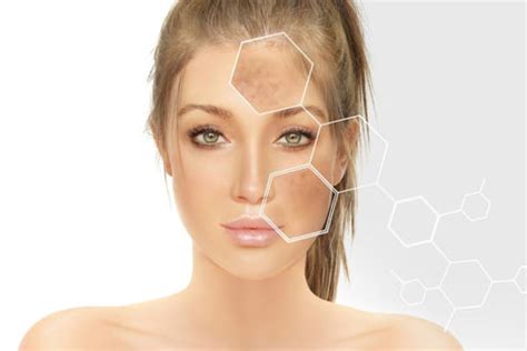 Kojic Acid vs. Glycolic Acid: Which Is Better for Skin Whitening ...