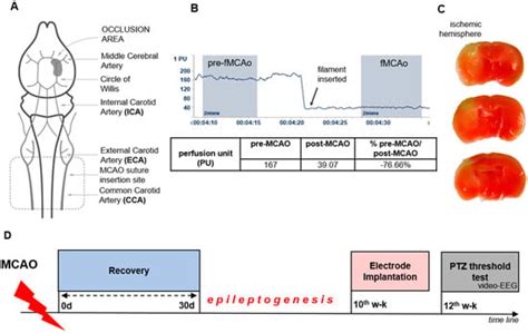 Matrix Metalloproteinase-9 Contributes to Epilepsy Development after ...