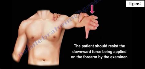 Rotator Cuff Muscles Test 的图像结果
