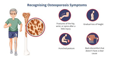 World Osteoporosis Day 2025: Understanding, Preventing, and Managing ...