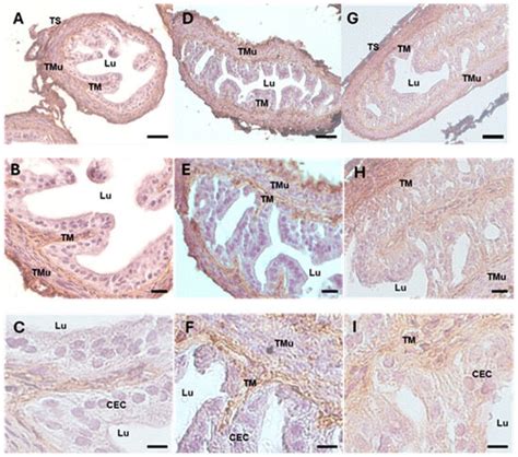 Morphological and Redox/Glycative Alterations in the PCOS Oviducts ...