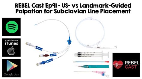 Subclavian Central Line Placement Landmarks