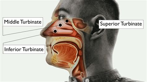 Nasal Turbinate Hypertrophy - Symptoms & Treatment
