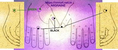 MIGRAINE: How energy acupuncture works! – ONNURI