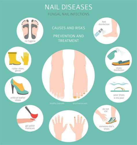 What Causes Toenail Fungus