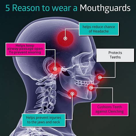 Anti Snoring Adjustable Mouth Guard For Sleep Apnea & Bruxism & Teeth – Timeless Matter