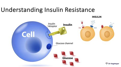 How Insulin Resistance and High Blood Sugar Affect Women's Hormone ...