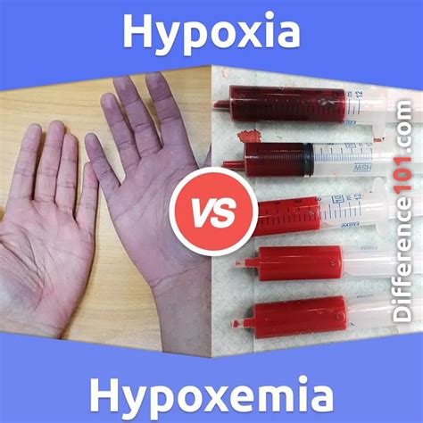 Hypoxia vs. Hypoxemia: What’s The Difference Between Hypoxia And Hypoxemia? : r/difference101