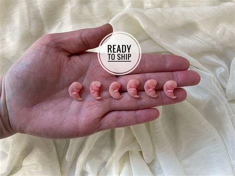 Miscarried Embryo At 2 Weeks