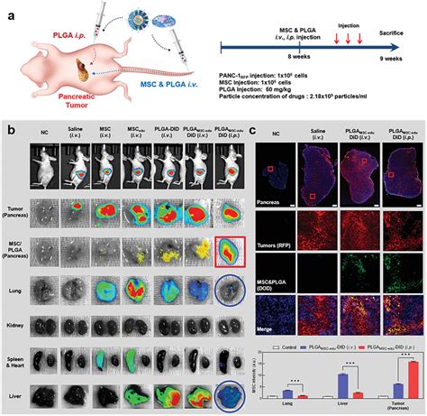 Image result for Intraperitoneal Injection to Kids