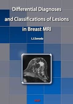 Buy Differential Diagnoses and Classifications of Lesions in Breast MRI ...