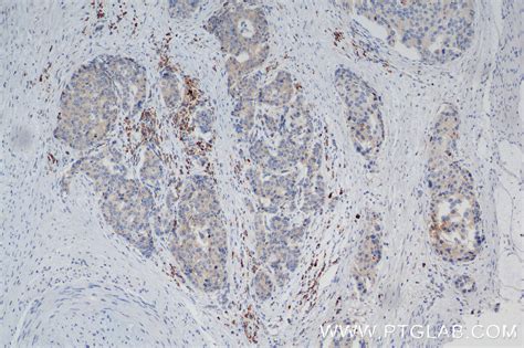 SPOCK1 antibody (84977-1-RR) | Proteintech