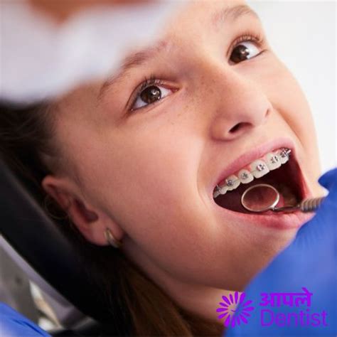 How to Choose the Right Dental Braces Treatment in Pune?
