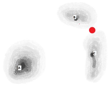 Image result for Fuzzy Matching Examples