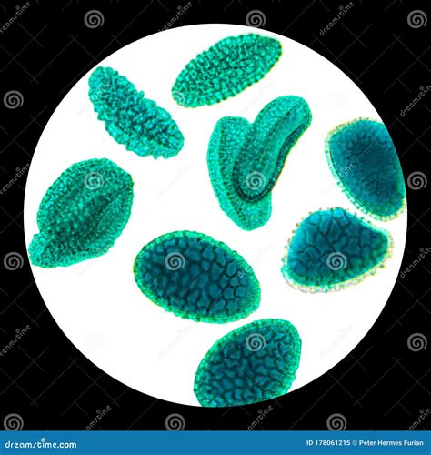 Pollen Grains Under the Light Microscope Stock Image - Image of nature ...