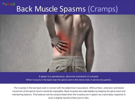 Lower Back Muscle Spasm 的图像结果