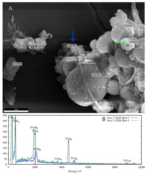 In Vitro Interactions of TiO2 Nanoparticles with Earthworm Coelomocytes ...
