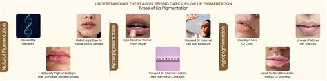 Causes of Lip Pigmentation – Understand Dark Lips & How to Treat Them ...