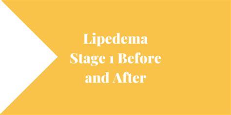 Lipedema Stage 1 Before and After - Lipedema and Me