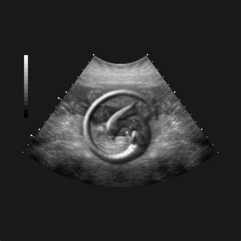 Image result for Alien Ultrasound